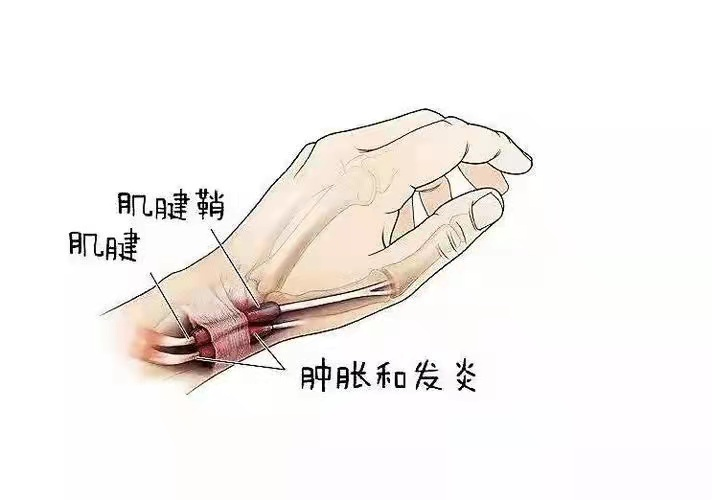 df6f467a592d418090900ca3aca65a9b.png