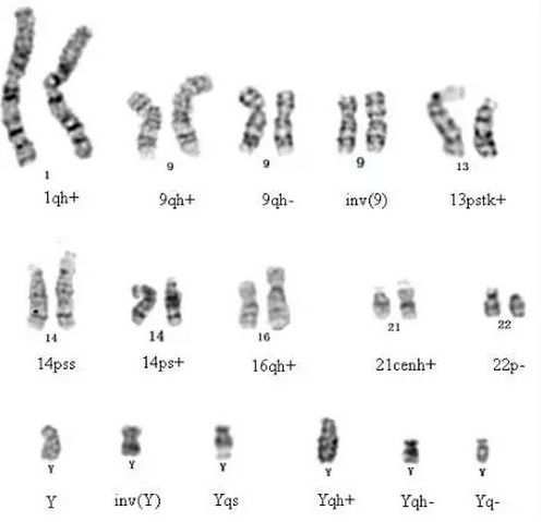 d2296e148dbb4dce878973aa5531661b.png