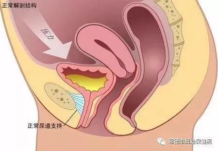 444444.webp.jpg